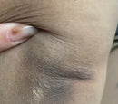 Dr. Melaxim Peel Shot – Exfoliante Facial Antimanchas y Antiedad